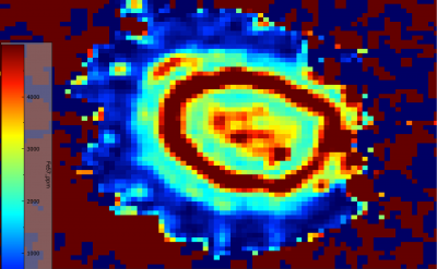 57fespherules