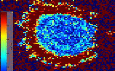 77sespherule