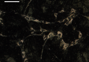 Figure 1. Dark field image of mesenchymal stem cells (MSCs) labeled with gold nanoparticles. Scale bar = 100 µm.