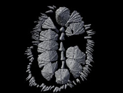 CT scan of multiplacophoran