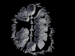 CT scan of multiplacophoran