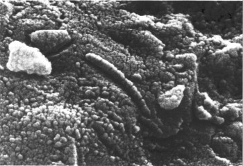An electron microscope scan of alh 84001, a meteorite from mars with features that were first interpreted as fossilized bacteria.