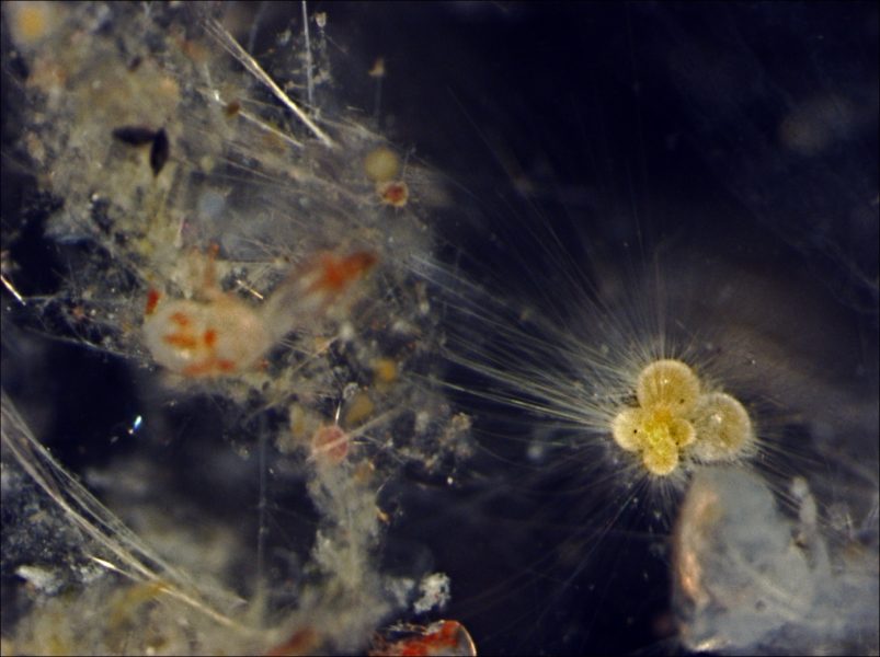 The yellow body of a barbed microorganism stands out against a dark blue background. It’s long filaments reach out and overlap those of other reddish looking organisms.