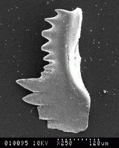 The teeth of a lamprey-like conodont