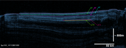figure1 Radargram, Mars North Polar Layered Deposits